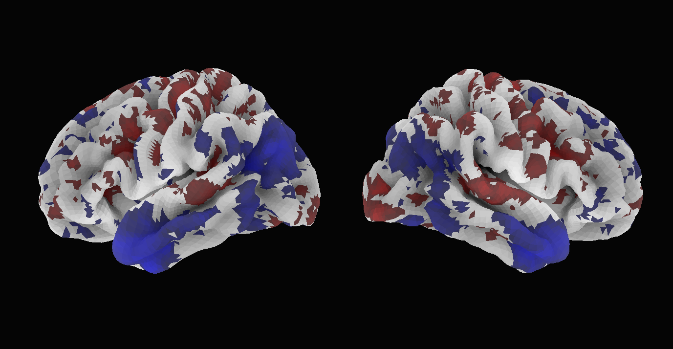 Flat response cortical activation pattern
