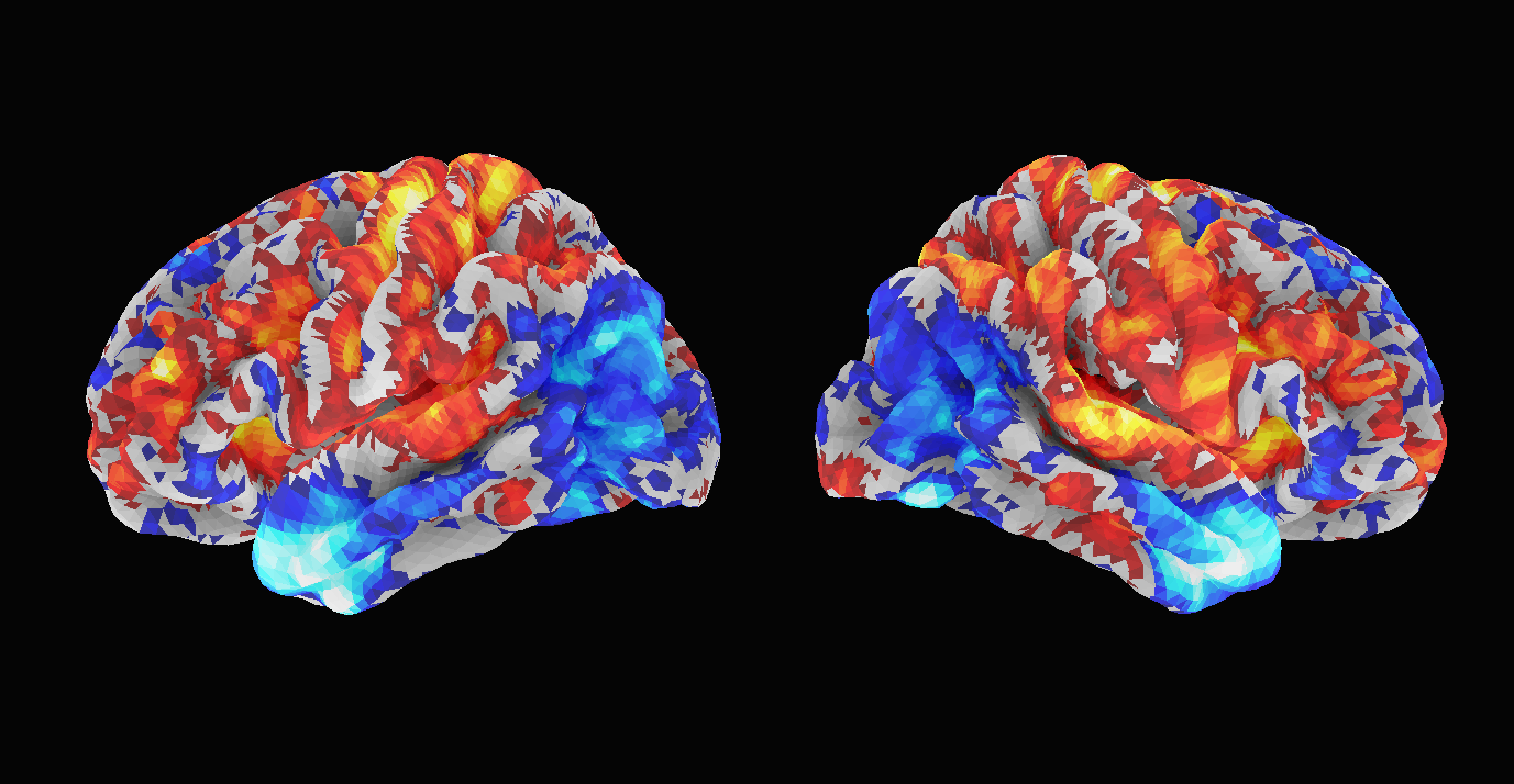 Ventral attention cortical activation pattern
